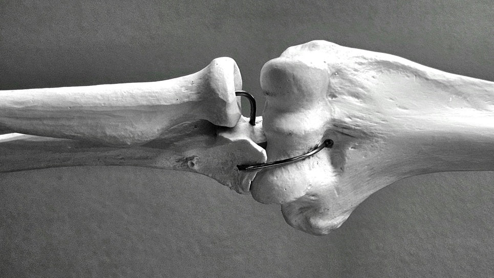 Ayurveda and Bone Health: An In-Depth Look